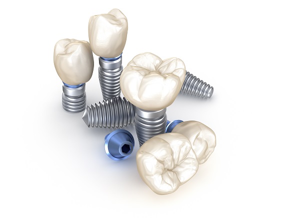 Dental Implant Restoration Bayside, NY