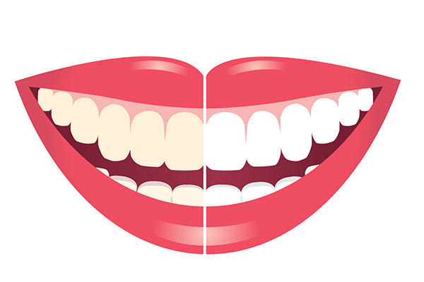 Daily General Dentistry Tips to Prevent Stained Teeth from Dazzling Smile Dental Group in Bayside, NY
