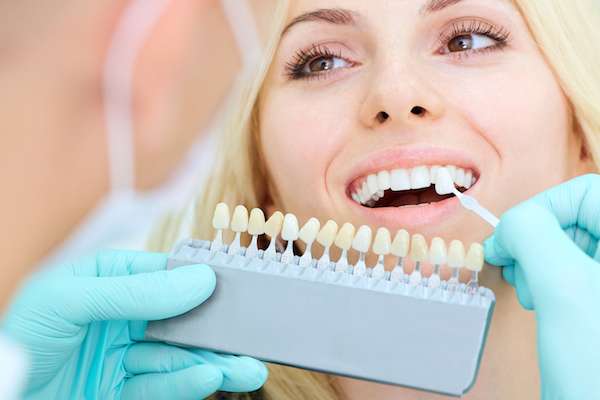 How a Cosmetic Dentist Places Dental Veneers from Dazzling Smile Dental Group in Bayside, NY