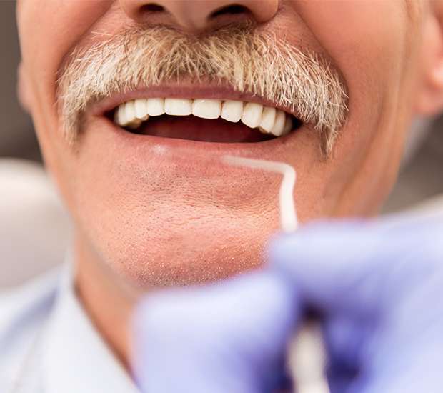 Bayside Adjusting to New Dentures