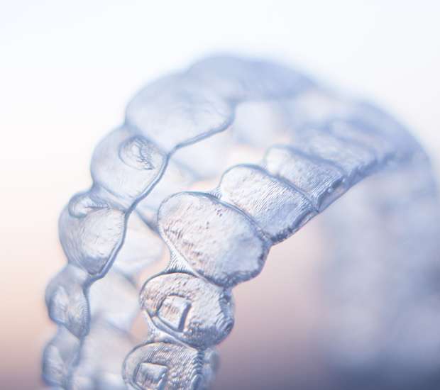 Bayside ClearCorrect Braces