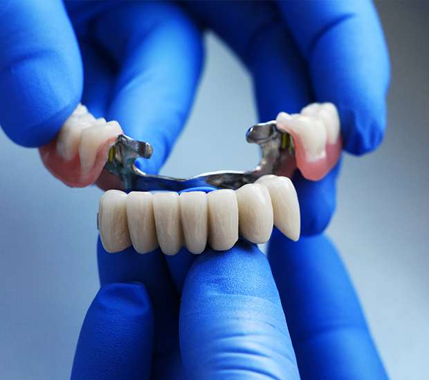 Bayside Dental Bridges
