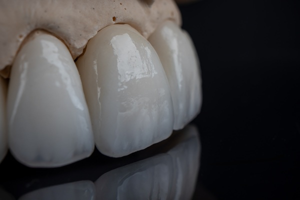 What To Do If Your Dental Crown Falls Off