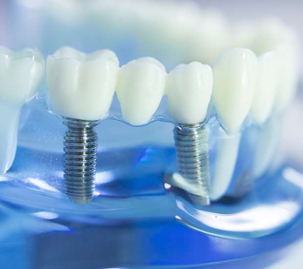 Bayside Dental Prosthetics