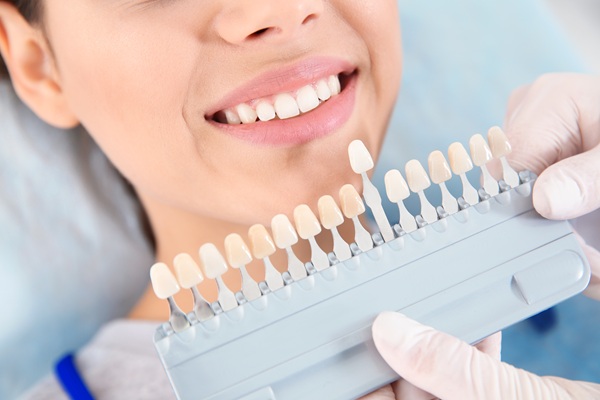 A Step By Step Guide To No Prep Dental Veneers