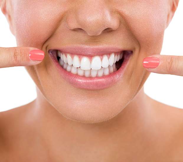 Bayside What Is Gum Contouring & Reshaping