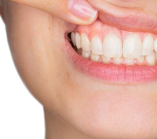 Bayside Gum Disease