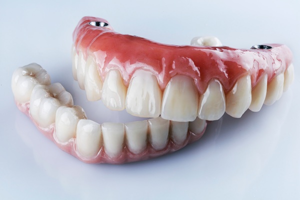 Caring For The Gums Under Implant Supported Dentures