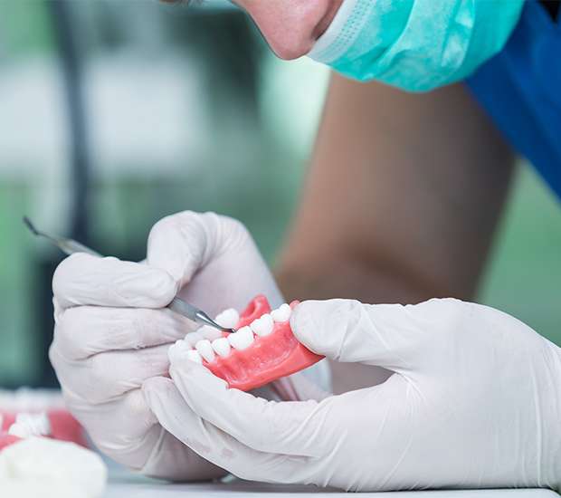 Bayside Partial Dentures for Back Teeth