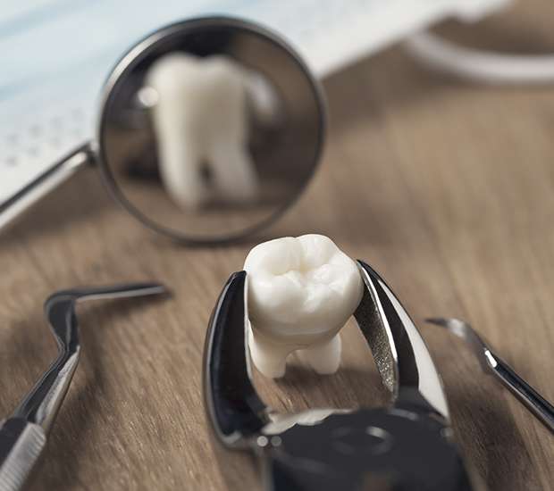 Bayside When Is a Tooth Extraction Necessary